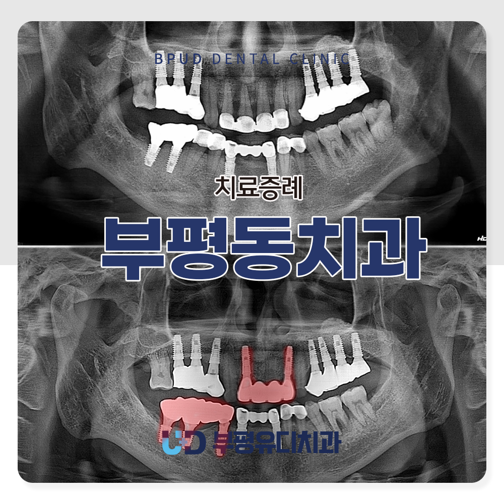부평동치과

