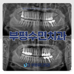 부평수면치과