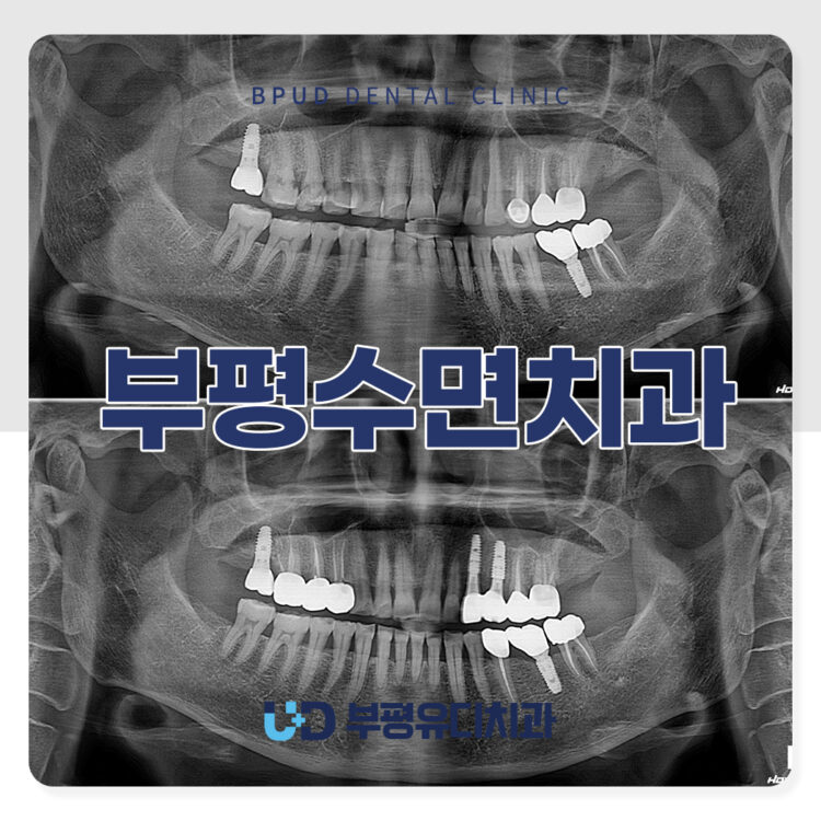 부평수면치과
