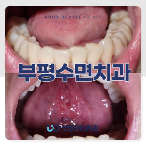 부평수면치과