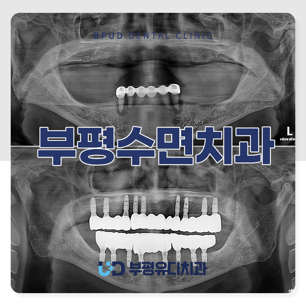 부평수면치과
