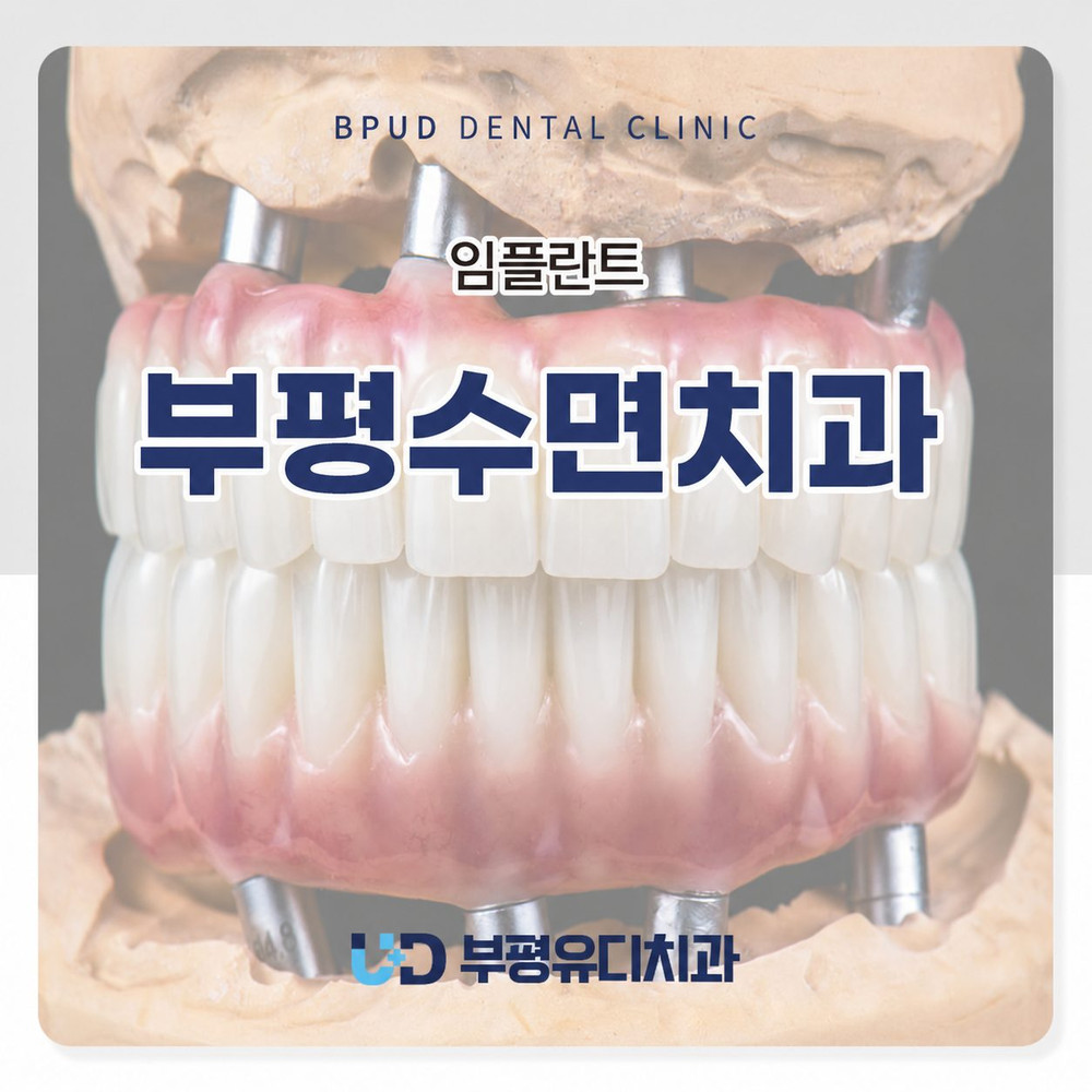 부평수면치과 무치악 식사 불편 시 전체 임플란트 고려 기준과 추천 확인점 정리